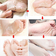 Chaussettes exfoliantes anti-callosités Footsteps