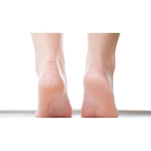 Chaussettes exfoliantes anti-callosités Footsteps